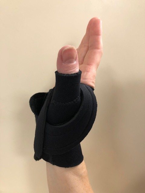 Image of hand in splint.
