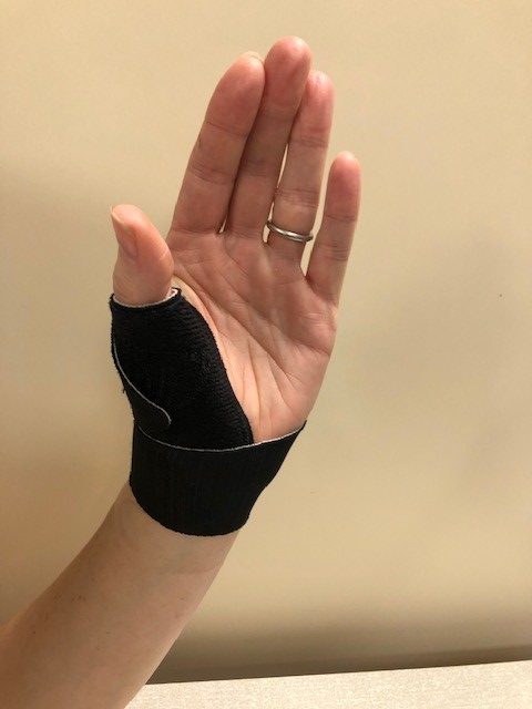 Image of hand in splint.