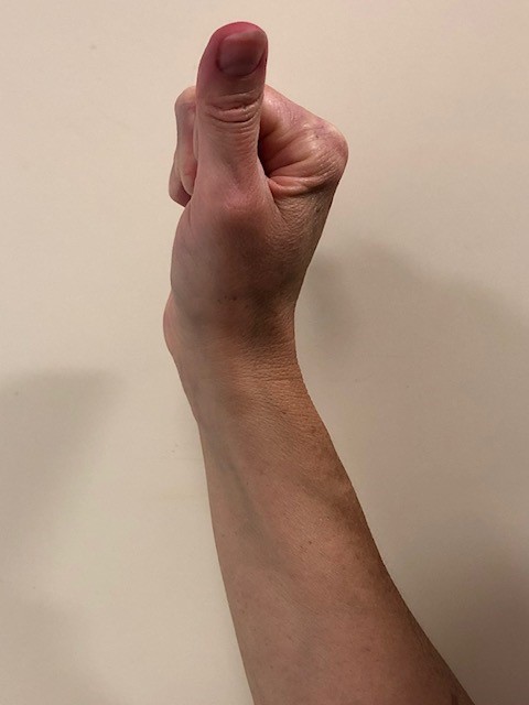 a fist with extended thumb