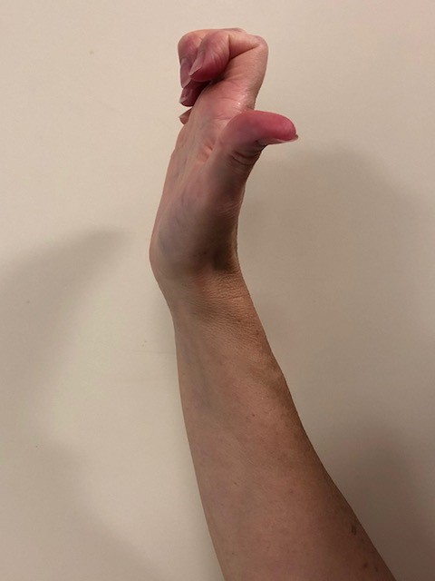 a hook fist