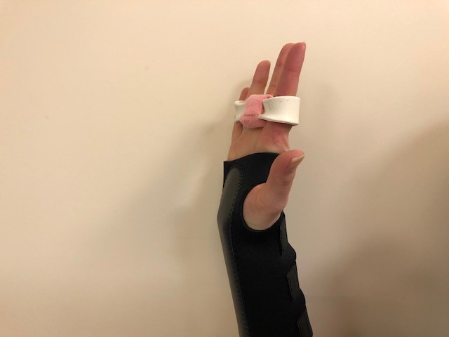 a straightened hand
