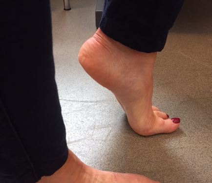 raised heel of foot