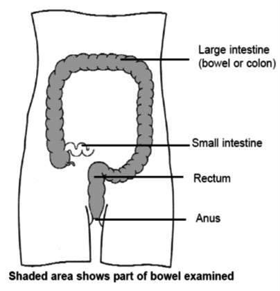 shaded area shows parts of bowel examined