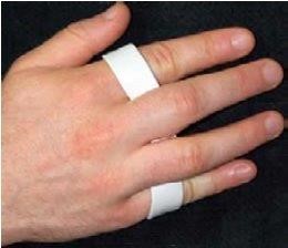 hand splint