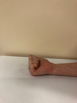 hand exercise