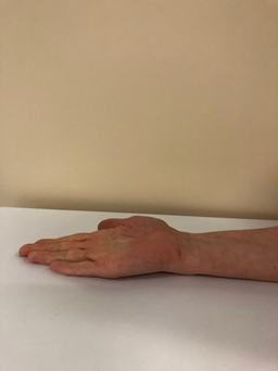 hand exercise