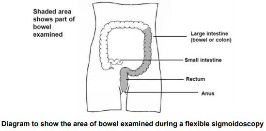 area of bowel examined during a flexible sigmoidoscopy.
