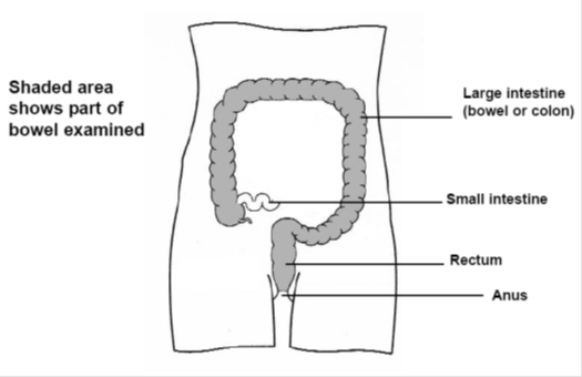 shaded area shows part of bowel examined in a colonoscopy