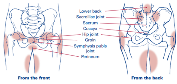 Pregnancy Related Pelvic Girdle Pain (PRPGP) - North Tees and