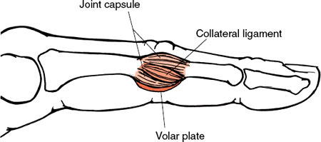 showing a cross-section of the volar plate.