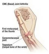 a cross section of the wrist, showing the bones mentioned above.