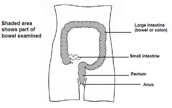 colon showing which areas are examined.