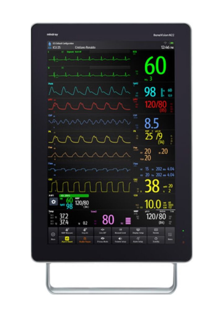 Heart Monitor