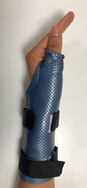 Thermoplastic splint