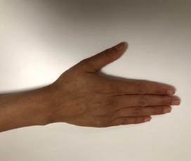 Second part of the Assisted Thumb Extension exercise.