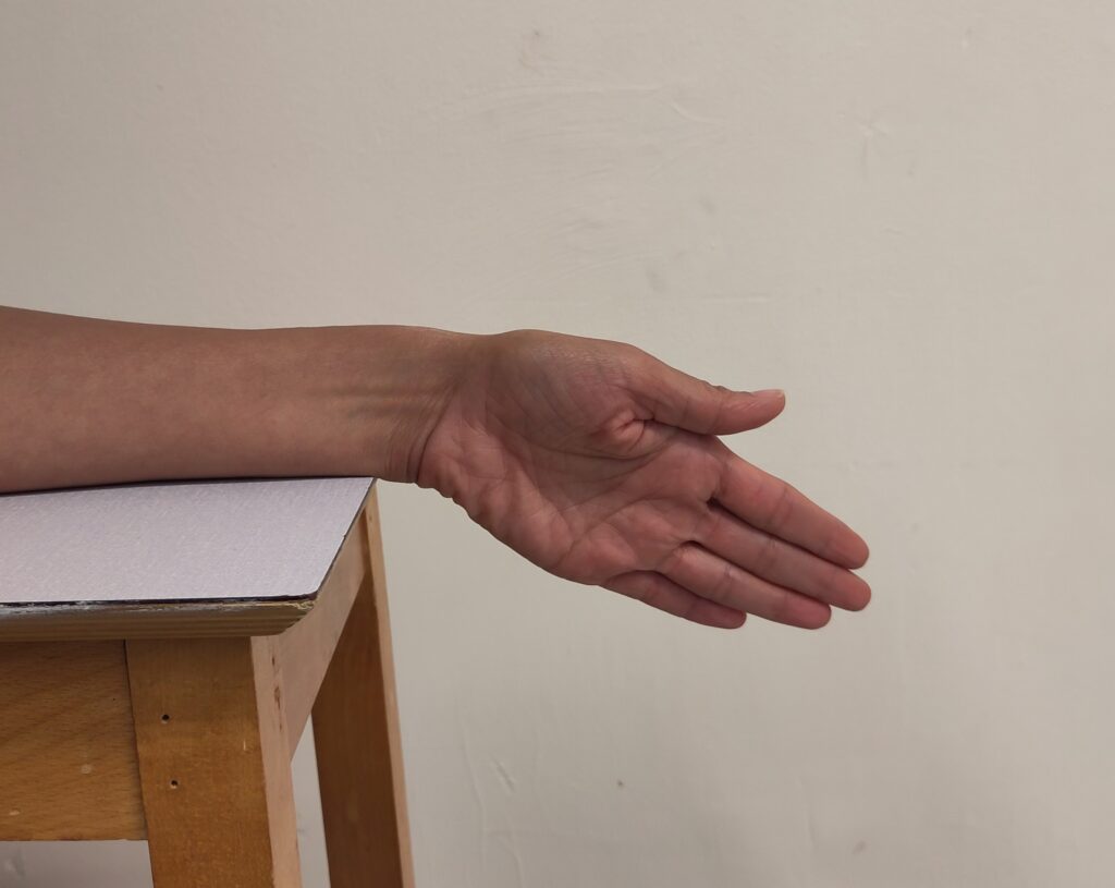 First part of the Assisted Wrist Deviation exercise.