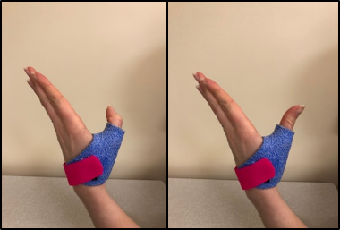 thumb bending exercise
