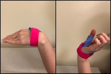 bending the wrist