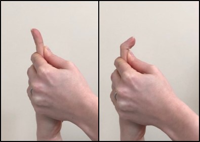 bent finger from the middle joint