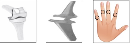 Pic 1 showing what a joint looks like.
Pic 2 is showing a plastic/metal surface replacement.
Pic 3 is showing the middle joint of each finger.