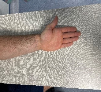 Active Pronation/Supination - Step 1