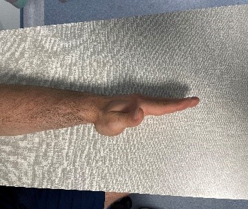 Active Pronation/Supination - Step 2