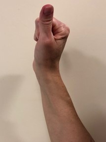 Tendon Glide - Step 3