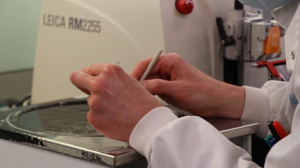 Pathology laboratory staff member performing test on patient sample
