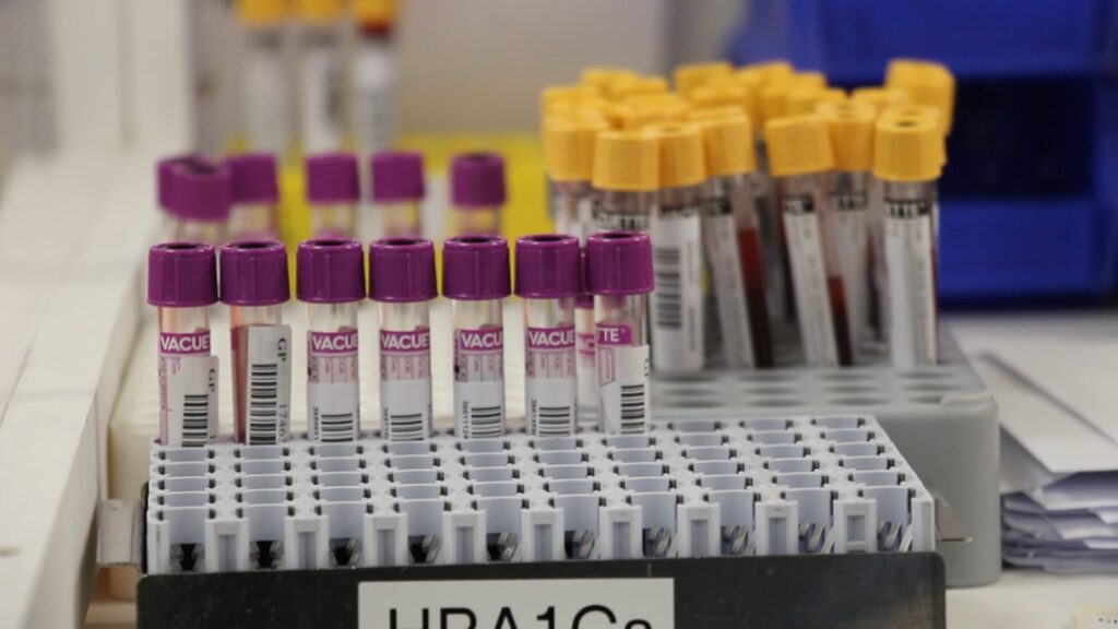 Blood test tubes in pathology lab