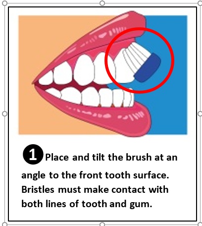 Brushing the front set of teeth with the brush at an angle.
