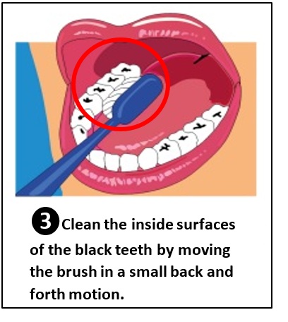 Brushing the inner sides of the teeth.
