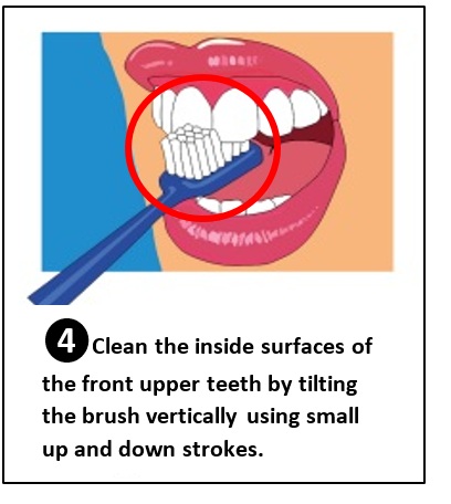 Brushing the front, upper teeth.