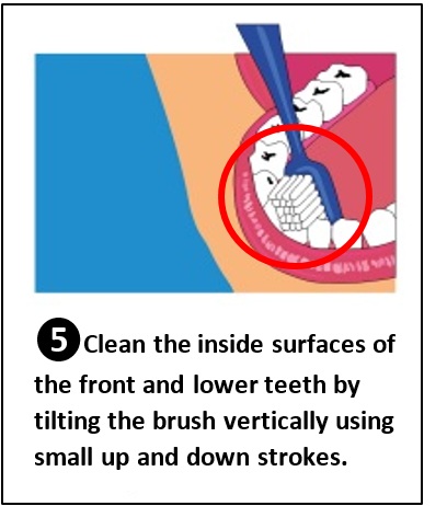 Brushing the front, lower teeth