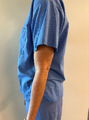 An arm hanging down in a relaxed position.