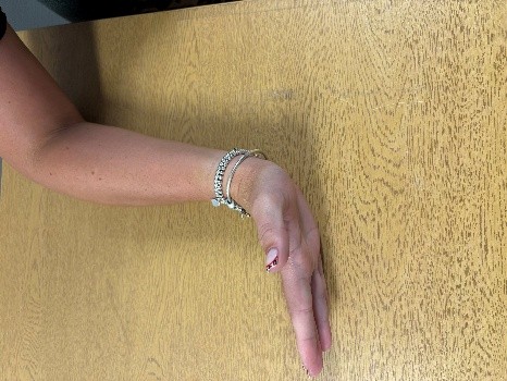 Hand bent backwards at the wrist.