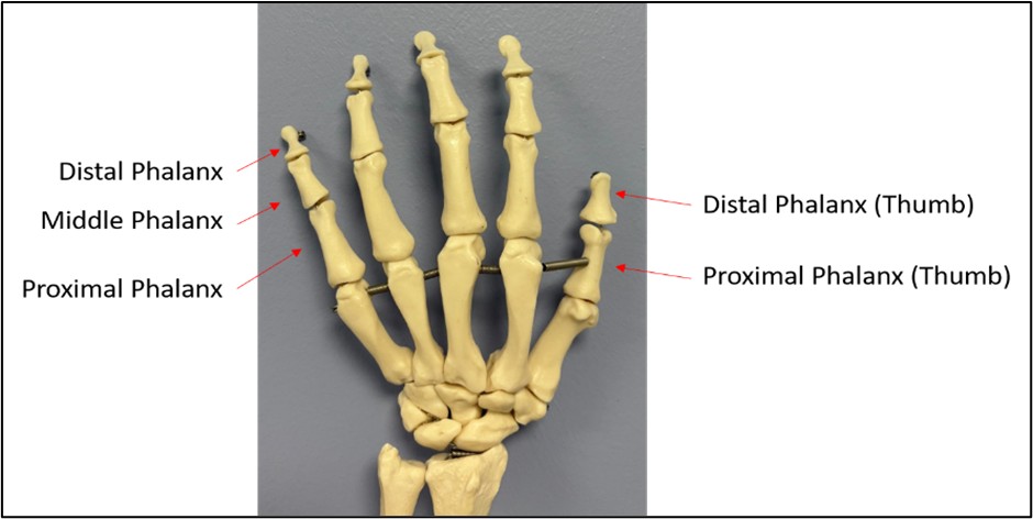 Picture of a hand showing the bone structures and what they are called.