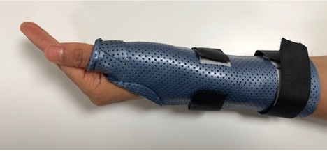 Picture of a thermoplastic splint