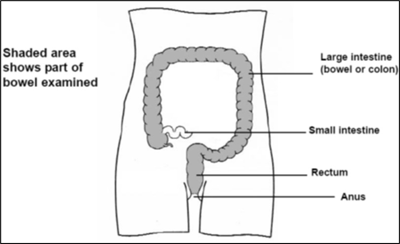 Image showcasing the large intestine, small intestines, rectum and anus.