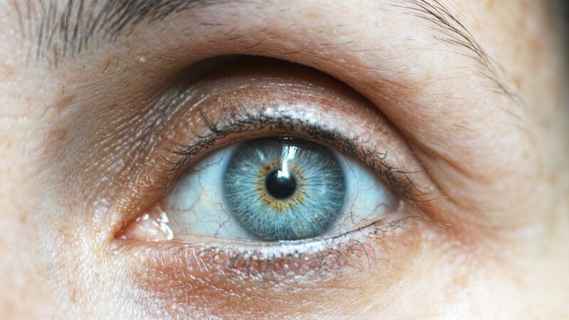Image of an eye