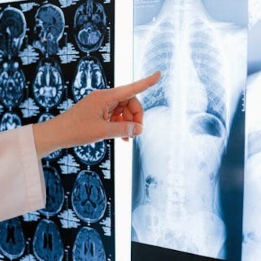 finger pointing at x-ray results