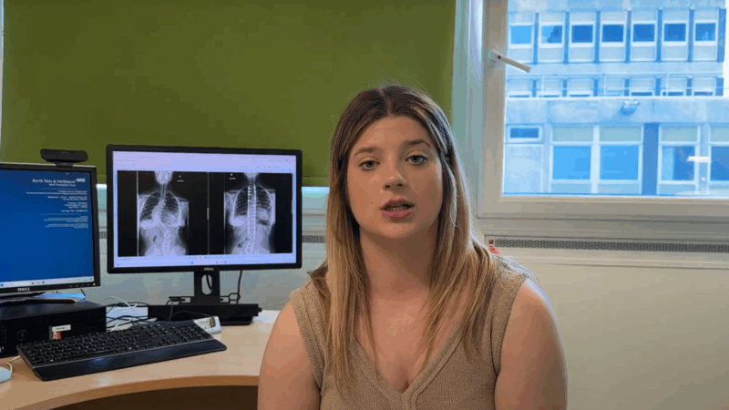 Scoliosis patient talking about condition.