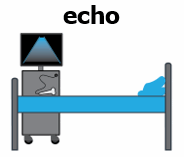 an echo machine